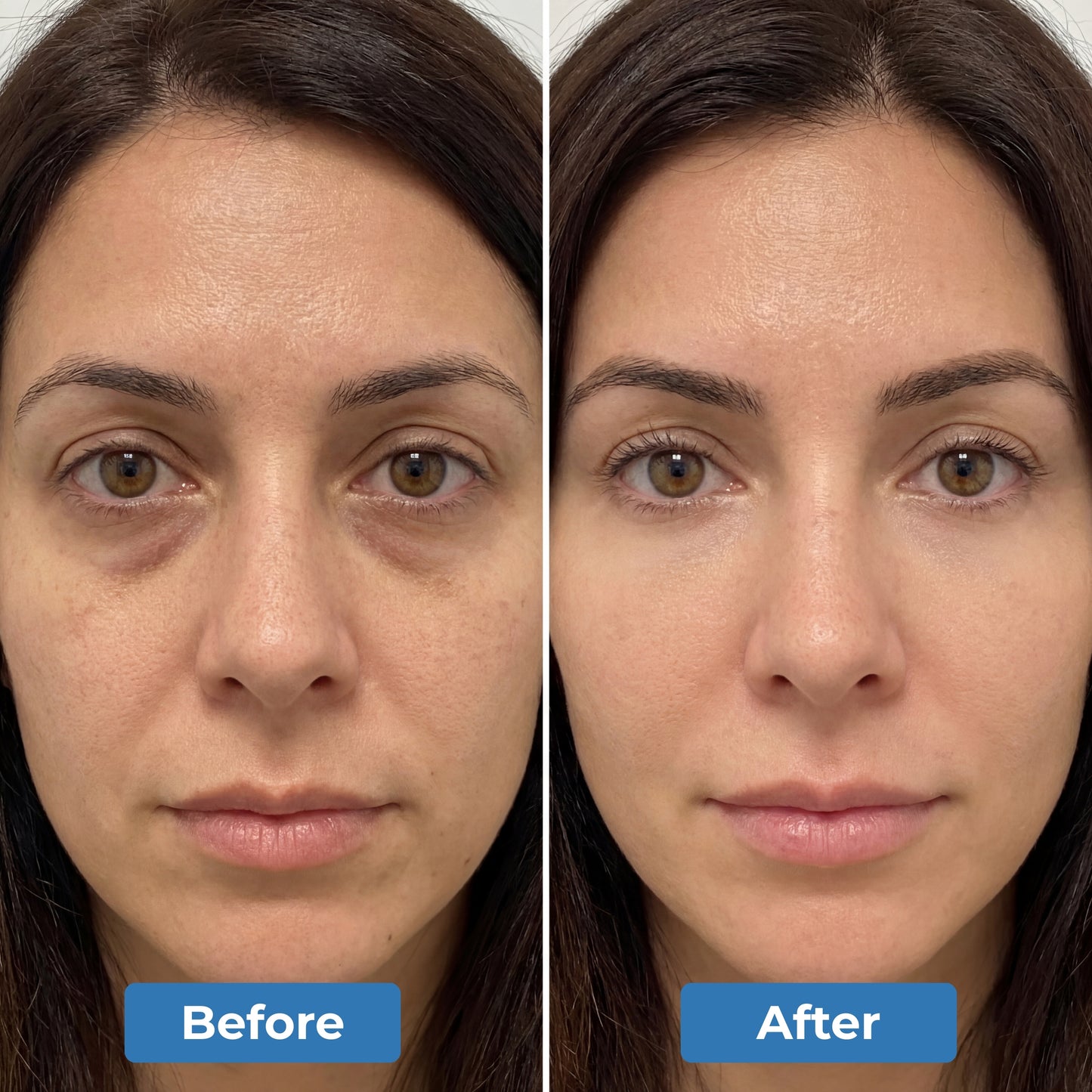 Red Light Therapy Mask